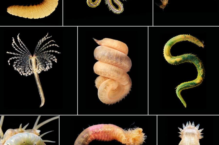 Klizma nepalīdzēs! Mīti par parazīttārpiem