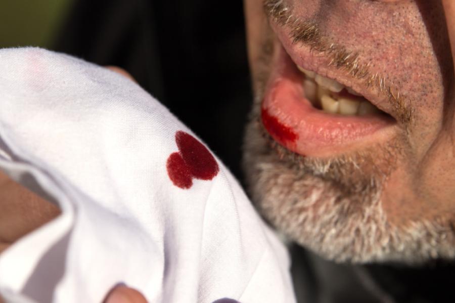 Klusā slepkava - tuberkuloze. Ko tu par to zini?!