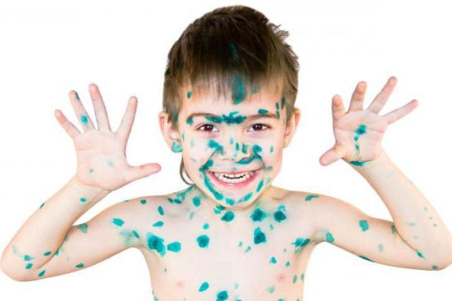 Vai «zeļonkai» jābūt mājas aptieciņā? Jautājam speciālistam