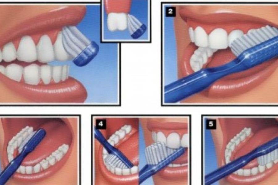 Speciālisti konsultē, kā Latvijas iedzīvotāji var paildzināt savu zobu veselību